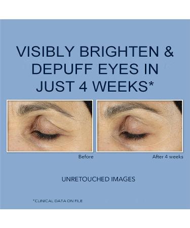 RoC Retinol Correxion Under Eye Cream Mini - Dark Circles & Puffiness Treatment | 0.25 oz Daily Wrinkle & Aging Skin Care - Buy Online on GoSupps.com