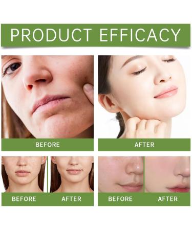 Gommage exfoliant pour le visage aux acides amin s l'aloe vera avec vitamine C - Gel peeling doux pour une peau lisse et lumineuse nettoie et hydrate en profondeur am liore la texture (5Pcs) - Buy Online on GoSupps.com