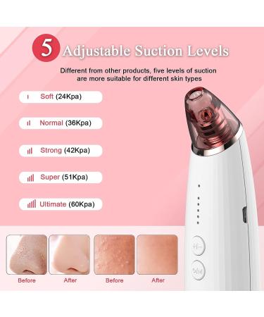 Blackhead Remover Vacuum with Pimple Popper Tool Kit | Electric Comedone Extractor for Skincare Treatment | Face Sucker for Acne Pimple Spot Suction - Buy Online on GoSupps.com