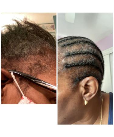 Rosemary Mint Eucalyptus Hair Oil | Thicker Longer & Fuller Hair | Nourishes Split Ends & Dry Scalp - 2 fl oz - Buy Online on GoSupps.com