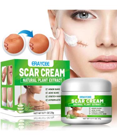 Scar Gel | Natural Calming Moisturizing Aloe Gel for Skin Lightening - Professional Scar Eraser Non-greasy Scar Repair Skin Care for Wounds Sysdisen - Buy Online on GoSupps.com