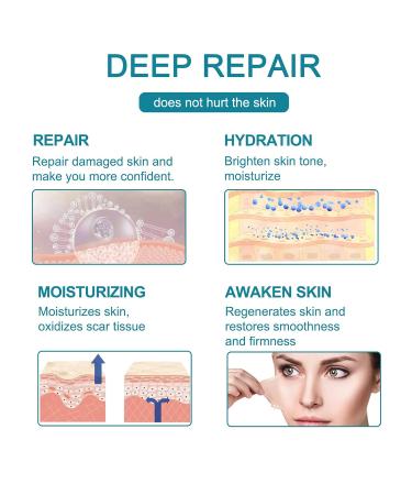 Meinuo Silicone Scar Sheets - Roll Scar Tape for Safe & Painless Scar Removal - 1.6 x 120 - Ideal for Body, Burn, C-Section, Keloid, Acne, Surgery - Buy Online on GoSupps.com