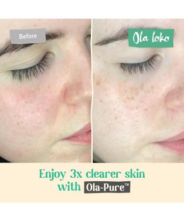 Ola Loko Mud Mask - Exfoliating Detox Clay Mask for Face and Skin, 8.5 Fl Oz - Buy Online on GoSupps.com