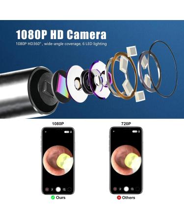 NANANARDOSO Wireless Ear Wax Removal Camera with 1080P HD Endoscope Otoscope - 6 LED Lights, 6 Ear Spoons, Compatible with iPhone, iPad, Android Phones - Buy Online on GoSupps.com