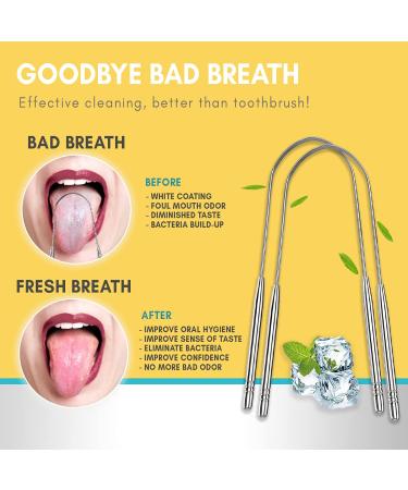 URBN LIVING U-Shaped Tongue Scraper Cleaner - 2 Pack with Metal Travel Case | Premium Grade Stainless Steel | Great for Healthy Oral Hygiene & Fighting Bad Breath - Buy Online on GoSupps.com