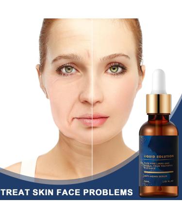 Buy 3 PCS Botox Face Serum | Aloe & Vitamin C Anti-Wrinkle Solution for Youthful Skin - International Shipping Available - Buy Online on GoSupps.com