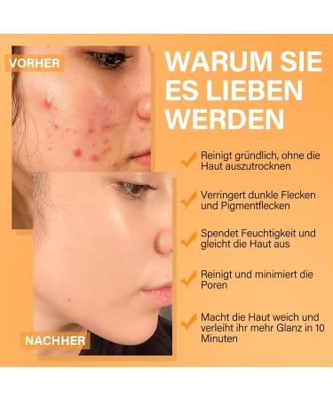 ulluxe Facial Mask Set Turmeric Vitamin C clay mask facial mask with salicylic acid Dead Sea mud facial clay mask for cleaning pores against blackheads dark spots 3x80g - Buy Online on GoSupps.com