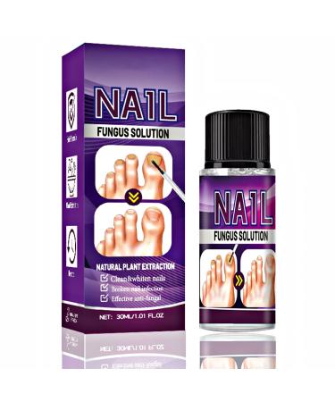 Fungal Nail Treatment Plant Essence Treatment Solution 30ML Special Nail Care Solution Athlete's Foot Toenails Broken Nails And Discolored Nails Restore Healthy Nails