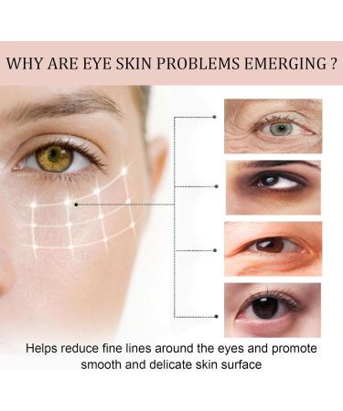 Eye Cream Stick Radiant Eyes Anti-Aging Eye Balm for Dark Circles under Eye - Firming & Brightening Eye for Wrinkles Eye Bags Dark Circles and Puffiness - Buy Online on GoSupps.com