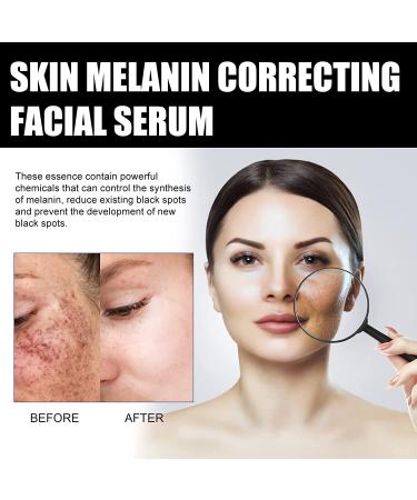 Eelhoe Vitamin C Serum Bundle with Hyaluronic Acid - Anti Aging & Melanin Correcting Formula - Buy Online on GoSupps.com