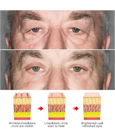 YANINEE 4 Pack Eye Gel Firming Eye Cream for Open Eyes Peptides Lifting Anti-Aging Eye Cream for Men Women - Buy Online on GoSupps.com