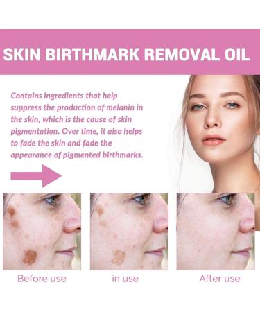 How to Make Dark Spots Essential Oil Oil Dead Skin Extra Strength Skin for Dark Body Spots Suitable for dark skin body face Bexdug - Buy Online on GoSupps.com