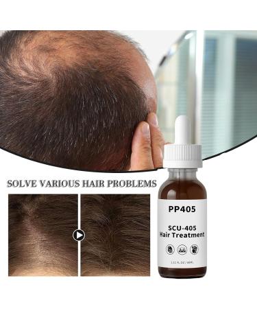 PP405 Huile de traitement du cuir chevelu et cheveux - s rum nourrissant non gras pour tous les types de cheveux 60 ml 1PCS 200 g (Lot de 1) - Buy Online on GoSupps.com
