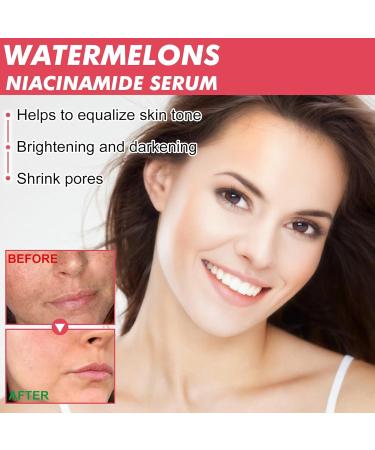 Watermelon Serum Watermelon Glow Niacinamide Moisturize Serum Niacinamide Serum Lightweight Hydrating Brightening Facial Serum Skin Lifting Anti-aging & Wrinkle Remove Face Serum for Women - Buy Online on GoSupps.com
