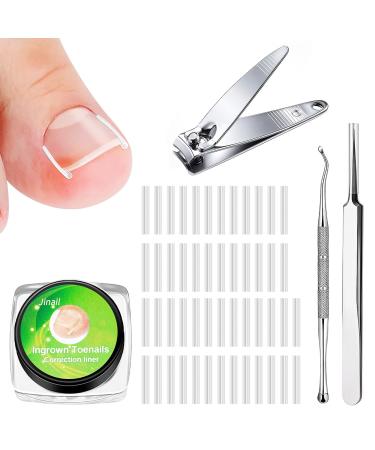 152 Pieces Ingrown Toenail Tool Set Toenail Correction Patch for Ingrown Toenails (Ingrown Toenails-7)