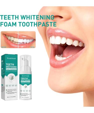 Ultra-Fine Saveuppro Teeth Whitening Mousse - Deep Clean Foam Toothpaste for Intensive Stain Removal & Whiter Teeth | Buy Internationally - Buy Online on GoSupps.com