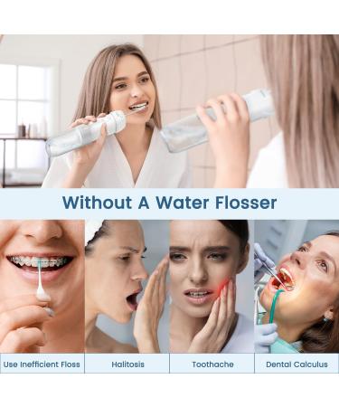 Portable Travel Water Flosser for Teeth Cleaning 3 Tips for Orthodontics & Braces Care | International Shipping - Buy Online on GoSupps.com