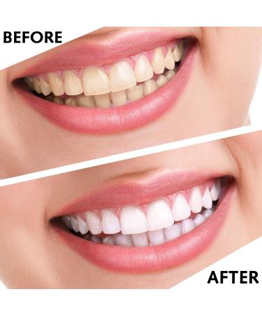 Ezranova 4 Pieces Teeth Whitening Mouth Trays Moldable Moldable Teeth Shelf Thermoplastic Tooth Protection Dental Care Set for Tooth Whitening Tooth Protection - Buy Online on GoSupps.com