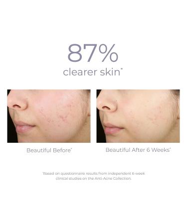 Blemish Control Serum: Target Acne with Powerful Treatment Formula - Buy Online on GoSupps.com