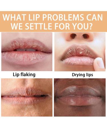  homomdy Turmeric Lip Balm for Dried and Cracked Lips Turmeric Lip Lightening for Dark Lips Lip Wrinkle Reduction Dull Dark Lip (6pcs) - Buy Online on GoSupps.com