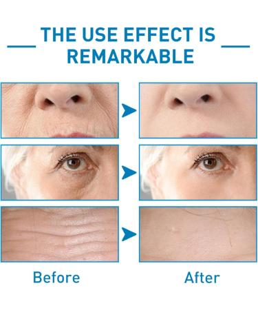 Salicylic Acid Hydrating Serum - Face Serum for Women - Dark Spot Correcting Glow Serum with 2% Salicylic Acid - Dark Spot Remover for Face - Moisturising and Soothing - Buy Online on GoSupps.com