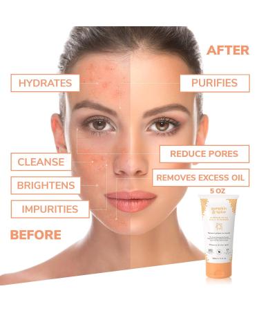 Pumpkin Spice Facial Jelly Cleanser - Natural Makeup Remover & Acne Treatment for All Skin Types - 5 fl oz - Buy Online on GoSupps.com