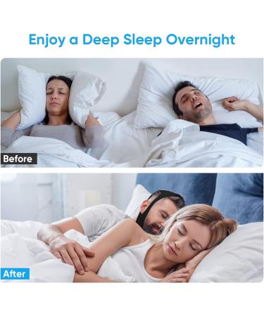 Adjustable Anti Snoring Chin Strap - Effective Solution to Stop Snoring - Unisex Black Design - Buy Online on GoSupps.com