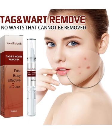 Wipe Off Tags & Moles Remover Fast Easy Effective in 5 Days Quick & Safe Remove Skin Tags Moles Remover Pen Liquid Mole Removal Pen for All Body Parts - Buy Online on GoSupps.com