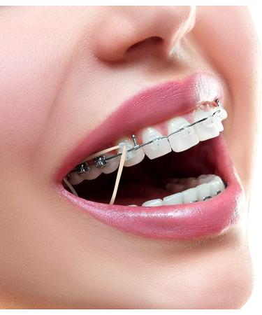 500PC Orthodontic Rubber Bands for Braces - Elastic Teeth Bands & Wax | Best Quality for Perfect Smile - Buy Online on GoSupps.com