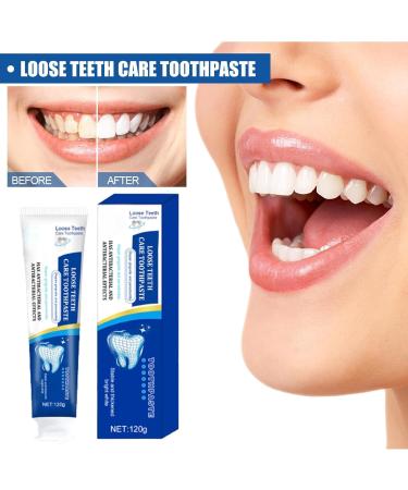 Enamel Repair Toothpaste Loose Teeth Care Toothpaste Whitening Repair and Protection Toothpaste Deep Cleaning Care Toothpaste - Buy Online on GoSupps.com