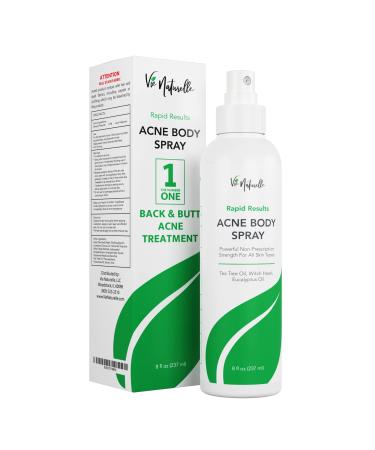Face  Body Acne Spray with Benzoyl Peroxide - Salicylic Acid - Butt  Back Acne Treatment - Cystic Hormonal Acne Treatment  Body  Chest Spray with Tea Tree Oil - for Men  Women  Teens - Acne Body Spray