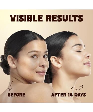 ISTON Vitamin C Face Serum - Hydrate & Rejuvenate with Hyaluronic Acid Niacinamide & Peptides - Anti-Aging Even Skin Tone Reduce Dark Spots - 1.69 Fl Oz - Buy Online on GoSupps.com