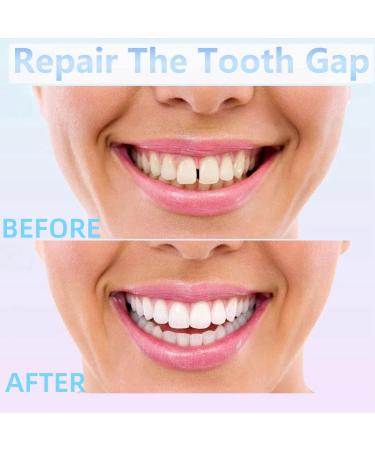 Temporary Tooth Filling Repair Kit - Moldable False Teeth Replacement | Tooth Repair Granules for Quick Fix | Fake Teeth Repair Beads - Buy Online on GoSupps.com