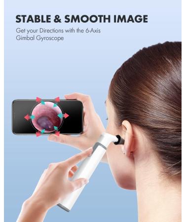 Anykit Wireless Otoscope Ear Camera | Dual View 3.9mm 720PHD WiFi Ear Scope with Ear Wax Removal Tool | For Kids, Adults, and Pets | Android and iPhone Compatible - Buy Online on GoSupps.com