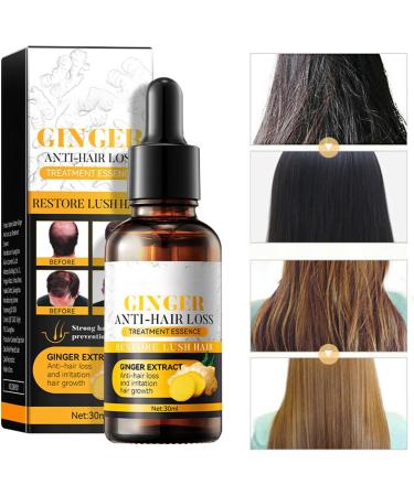 Natural Hair Regrowth - Hair Loss Treatment Volume & Root Booster 30ml Moisturizing Hair Treatment for Stronger Hair Plus Anloximt - Buy Online on GoSupps.com