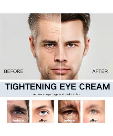 Tongyend Men Eye Serum Caffeine Eye Cream Instant Eye Tightening Cream Lifts Firming Anti-Wrinkle & Hyaluronic Acid Moisturiser Kojic Acid Eye Cream Instant Eye Lift & Eye Bag Depuffing Eye Gel - Buy Online on GoSupps.com