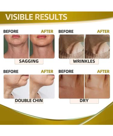 Collagen Face & Neck Tightening Cream Neck Firming Cream Tightening Lifting Sagging Skin Tightening and Repair Decolletage Cream Anti Aging Moisturizer for Neck D collet with Retinol Collagen - Buy Online on GoSupps.com