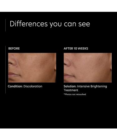 PCA SKIN Intensive Brightening Treatment - Vitamin A Retinol Serum for Dark Spots (1 oz) - Buy Online on GoSupps.com