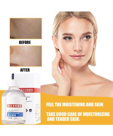 Aobenz Spot Remover for Face Dark Spot Remover for Face Anti Spot Serum Dark Spot Correcting Serum Skin Whitening Spot Treatment Freckle Remover Sun Spot Dark Spot Cream Brightening Serum 50ml - Buy Online on GoSupps.com