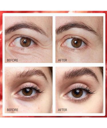 Buy Pomegranate Eye Cream | Anti-Aging Under Eye Cream for Dark Circles Puffiness & Fine Lines - Buy Online on GoSupps.com