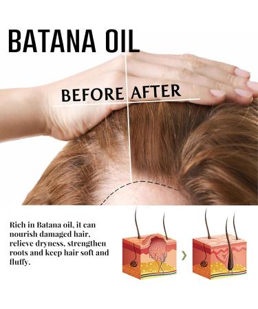 Batana oil shampoo bar and Batana oil for hair growth Natural Batana soap and hair serum to improve scalp health and promote growth Cleans and nourishes hair - Buy Online on GoSupps.com