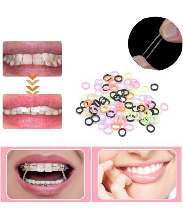 Angzhili 1000 Orthodontic Rubber Bands - Latex-Free Multicolored Elastic Ligaments (0.6 cm) for International Shipping - Buy Online on GoSupps.com