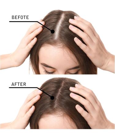Hair Building Fibres Hair Loss Concealer Professional Quality Fiber Hair Powder Spray for Thinning Hair Hair Thickening Products for Women- Dark Brown - Buy Online on GoSupps.com