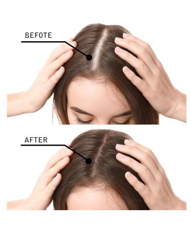 Hair Building Fibers for Thinning Hair - Natural Hair Thickener Undetectable Concealer - 15 Sec Coverage for Women - 0.97OZ Medium Brown - Buy Online on GoSupps.com