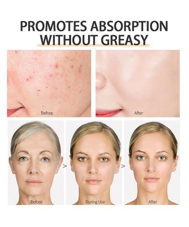 Grospe Black Honey Face Moisturizer Cream Anti-Aging Cream with Squalane Facial Moisturizer for Women Deep Hydrating Face Cream for Dry Skin Dark Spots & Wrinkles Barrier Repair & Firming 1.05 Fl Oz - Buy Online on GoSupps.com