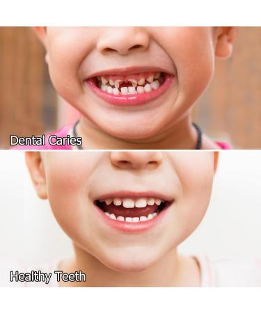 Kids Oral Spray, Toddler Toothpaste Helper for Cavity Prevention and Fresh Breath, Children Anticavity with Fluoride Free for Newborn to Preschoolers, Kid's Mouth Spray (1) - Buy Online on GoSupps.com