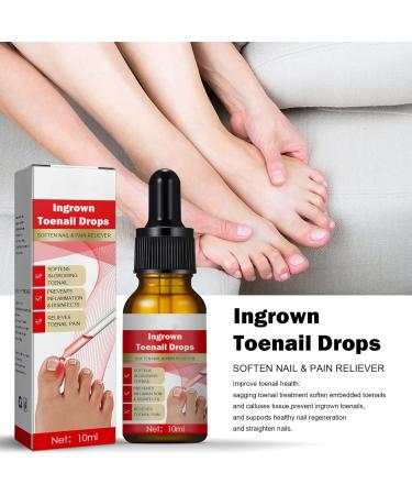 Ingrown Toenail Treatment Oil - Natural Solution for Ingrown Toenails & Fungal Nail Care | 1PCS - Buy Online on GoSupps.com