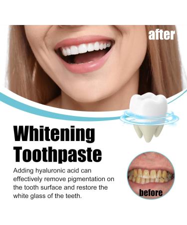 Whitening Toothpaste Removing Stains Whitening Toothpaste Clean Mouth Cool And Refreshing Fully Foam Brightening White Prevents Stains Protects Gums Fresh Breath Complete Care Teeth (3) - Buy Online on GoSupps.com
