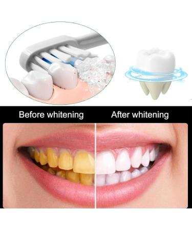 Probiotic Clarifying Toothpaste Gum Care & Fresh Breath Natural Probiotic-Enriched Formula Toothpaste for Sensitive Teeth Protection (2PCS) - Buy Online on GoSupps.com