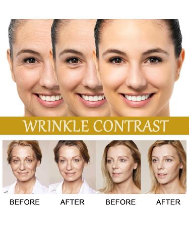 Advanced Bee Venom Serum | Anti-Aging Face Serum for Fine Lines & Wrinkles | Hydrating International Shipping - Buy Online on GoSupps.com